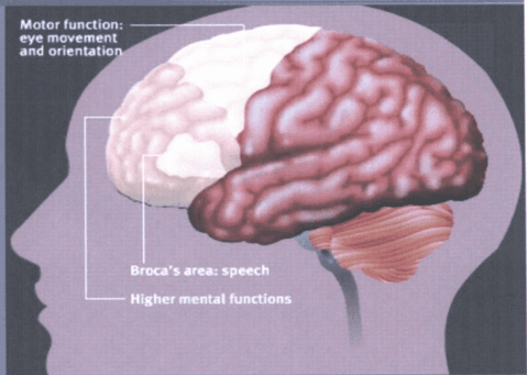 그림 1) Broca's Area