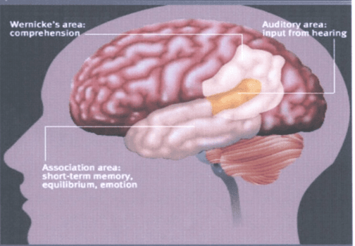 그림 2) Wernicke's Area